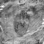 Drawings on aluminum of a heart.